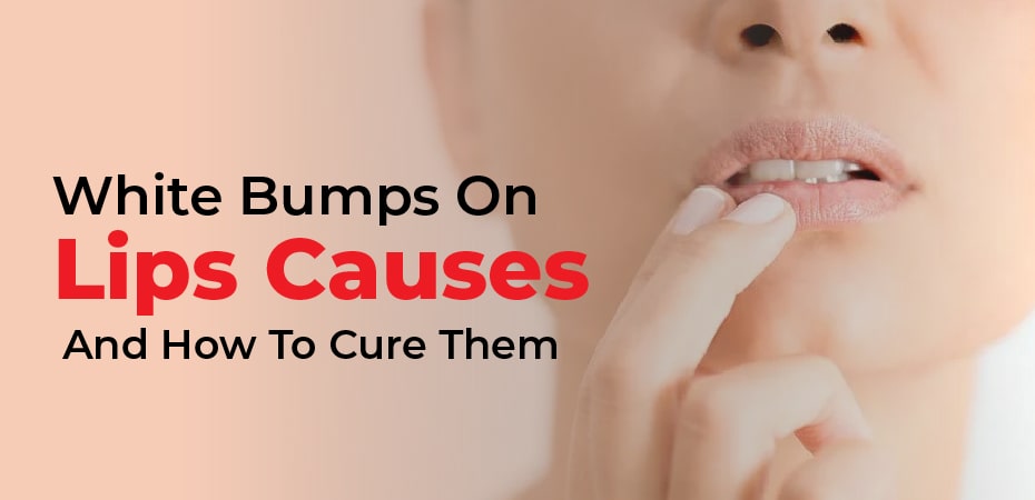 small white bumps on lips