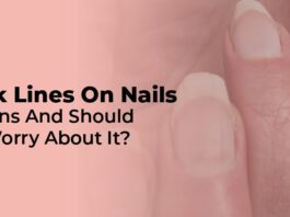 vertical black lines on nails