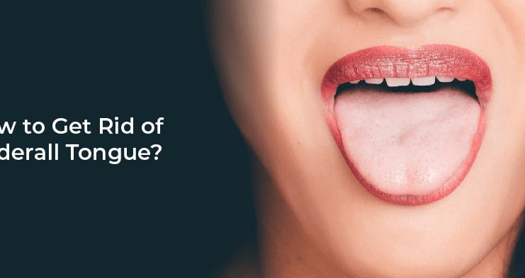 How to Get Rid of Adderall Tongue